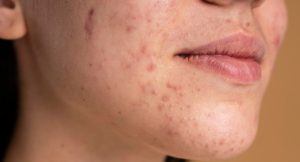 Sensitive Skin Care