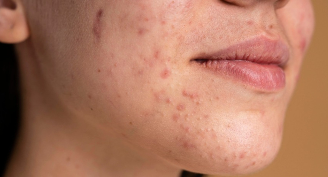 Sensitive Skin Care